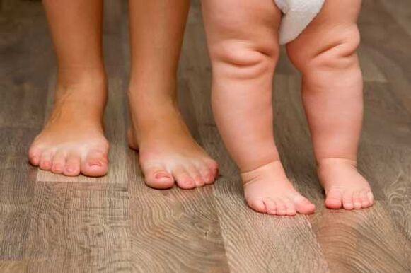 Παραμόρφωση Valgus σε παιδιά