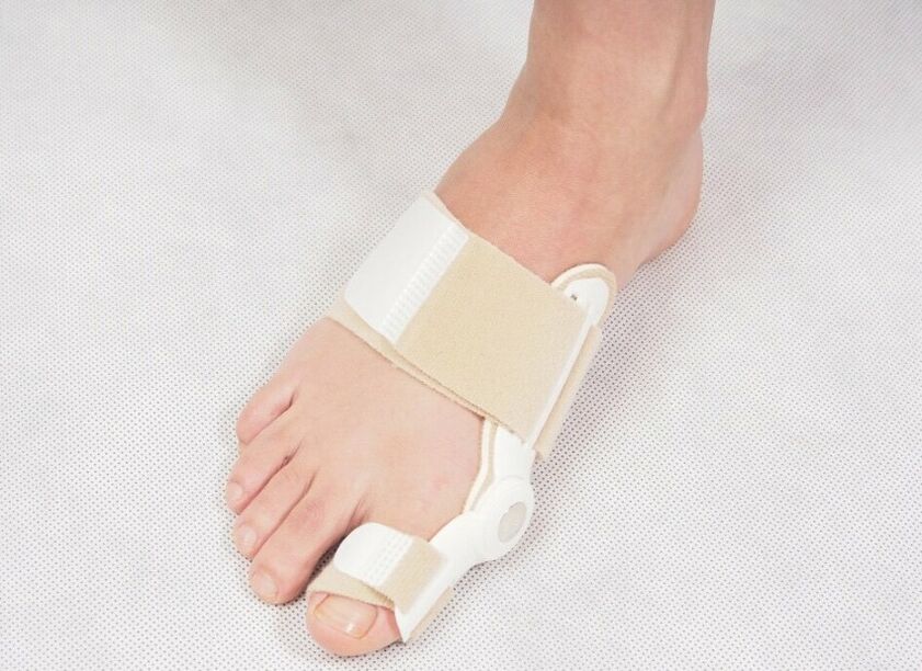 Διορθωτικός κορσές